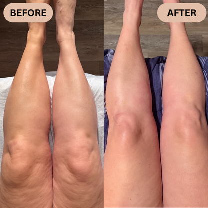 Lucid's Anti Cellulite Massage Oil
